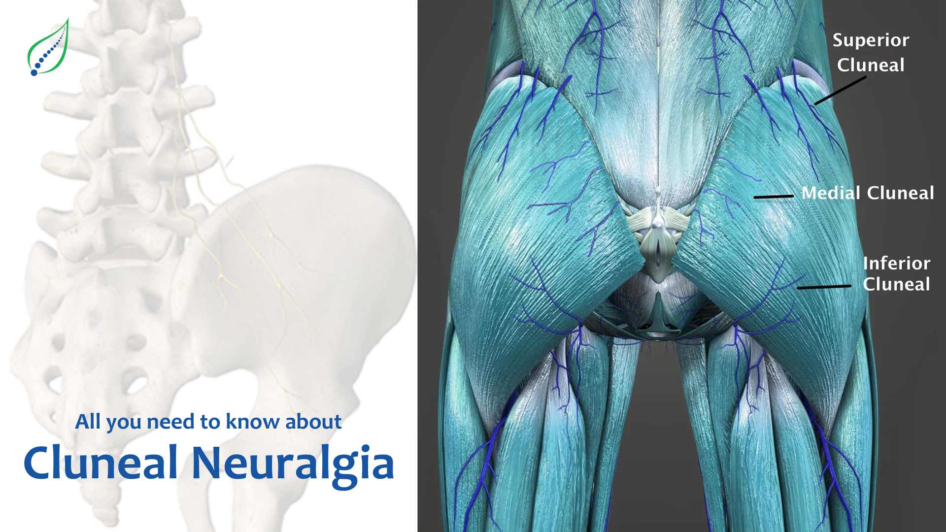 All you need to know about Cluneal Neuralgia